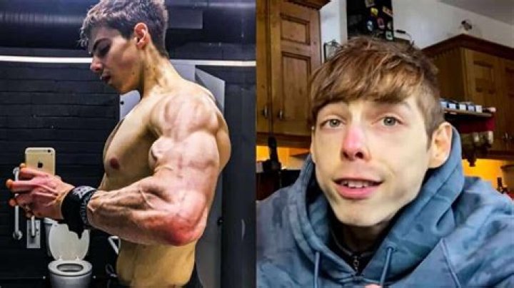 What Happened To Scott Murray? Cause Of Death And Funeral